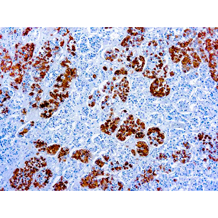 ACTH monoclonal antibody (AH26) Immunohistochemistry
