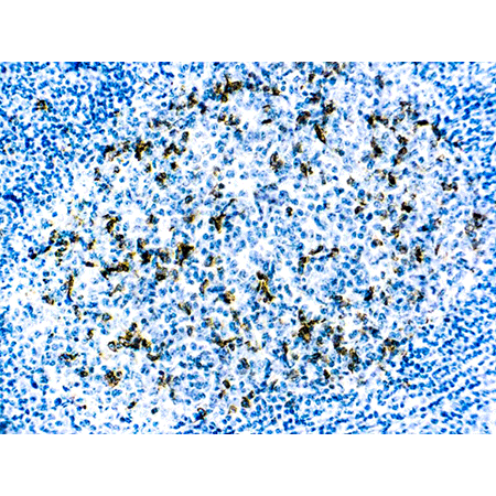 CD57 monoclonal antibody (NK-1) Immunohistochemistry
