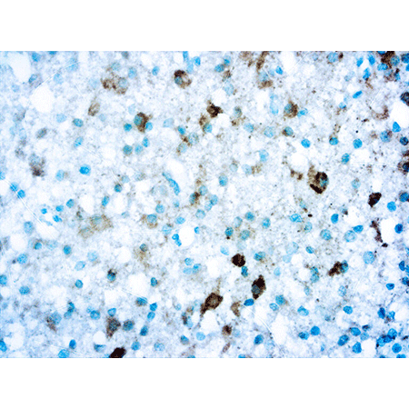 IDH1-R132S monoclonal antibody Immunohistochemistry