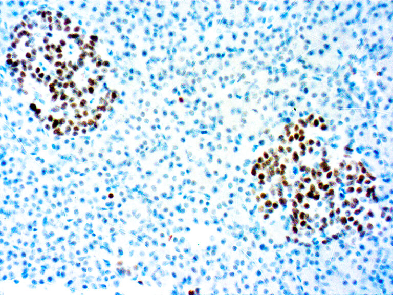 INSM1 monoclonal antibody (A-8) Immunohistochemistry