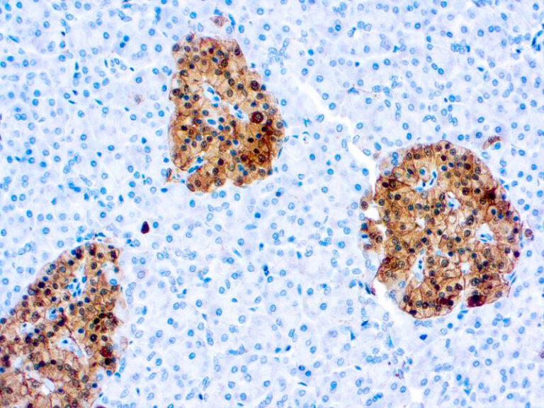 Neuron Specific Enolase monoclonal antibody (VI-H14) Immunohistochemistry