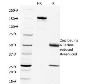 Rabies virus monoclonal antibody (Rab-50) SDS-PAGE