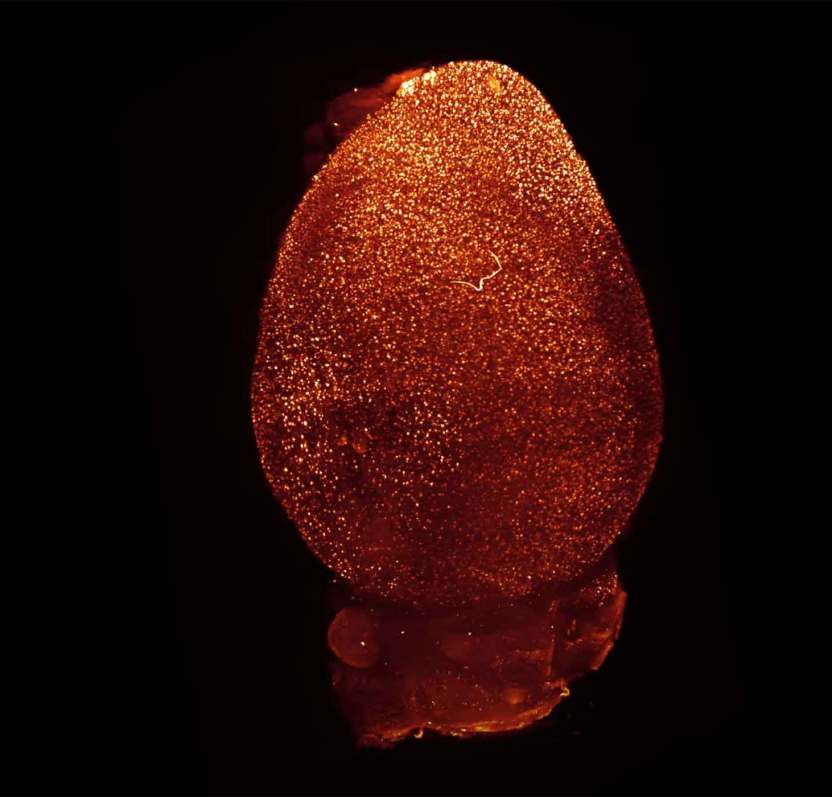 3D-reconstruction of MesoSPIM imaging of iDISCO-cleared and PROTEOSTAT® dye-stained APP/SP1 mouse brain