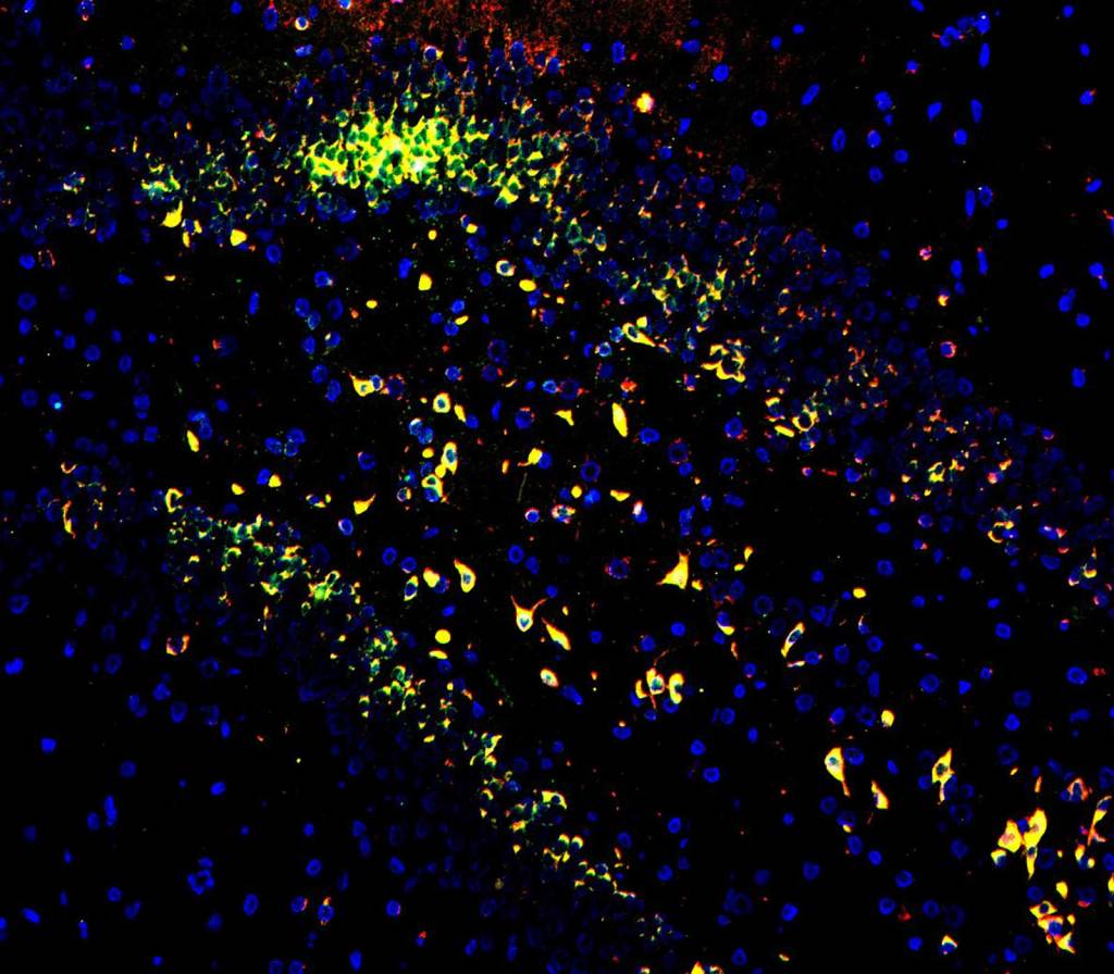 Multiomics Analysis: protein and non-coding RNA