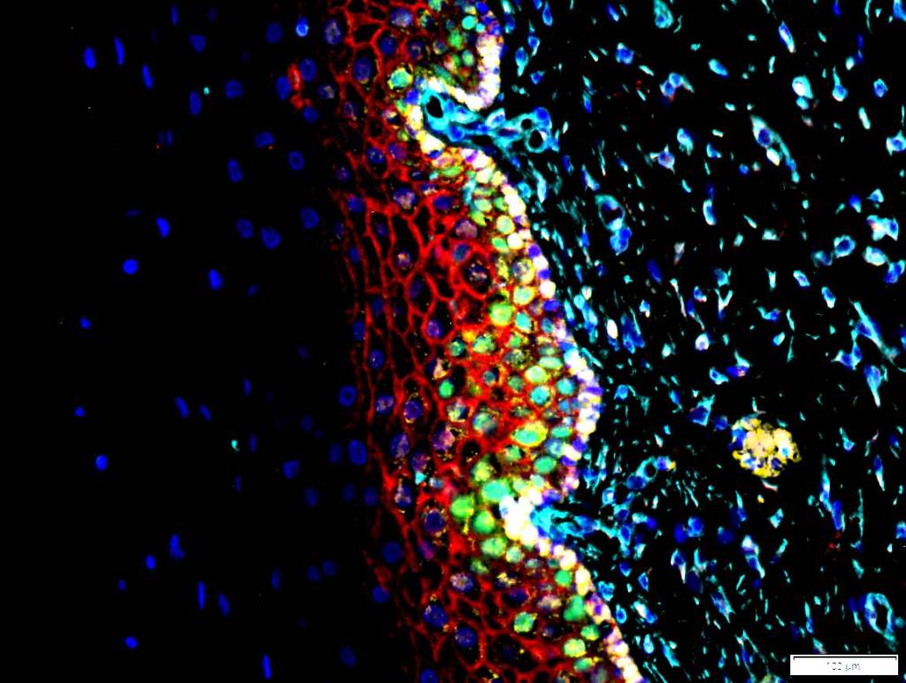 Multiomics Analysis: Multiplexing IF to detect several proteins