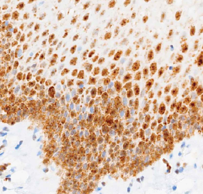 EGFR (brown) was detected in tonsil tissue with AMPIVIEW® EGFR (AS) Dig RNA Probes (ENZ-GEN129) using Ventana detection reagents on the Ventana Discovery Ultra.