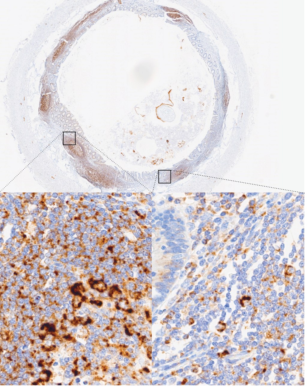 EGFR (brown) was detected in appendix tissue with AMPIVIEW® EGFR (AS) Dig RNA Probes (ENZ-GEN129) using Ventana detection reagents on the Ventana Discovery Ultra.